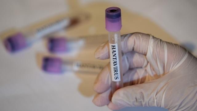 ÜST: Hantavirus yeni pandemiyanın başlanğıcı deyil